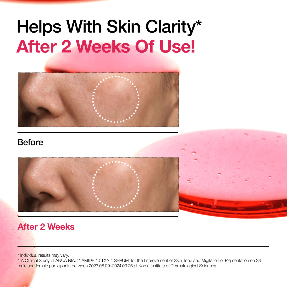 Suero Facial Anua Niacinamide 10% + TXA 4% Serum 30 mL