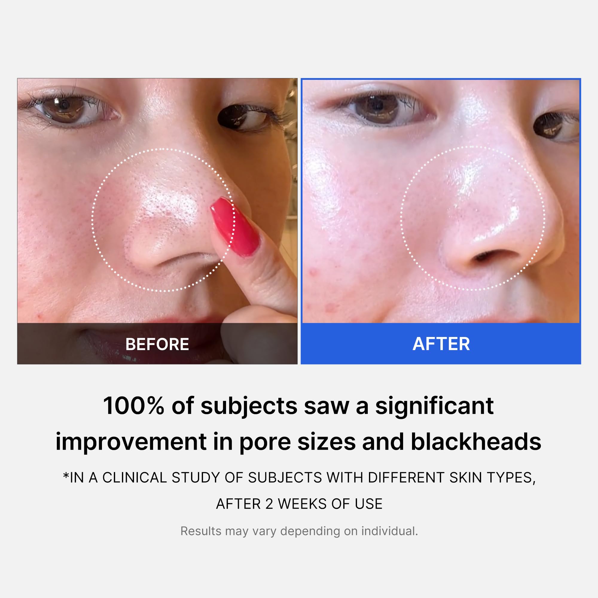 Crema Anti Poros MEDICUBE Zero Pore Cream 2.0 50 mL