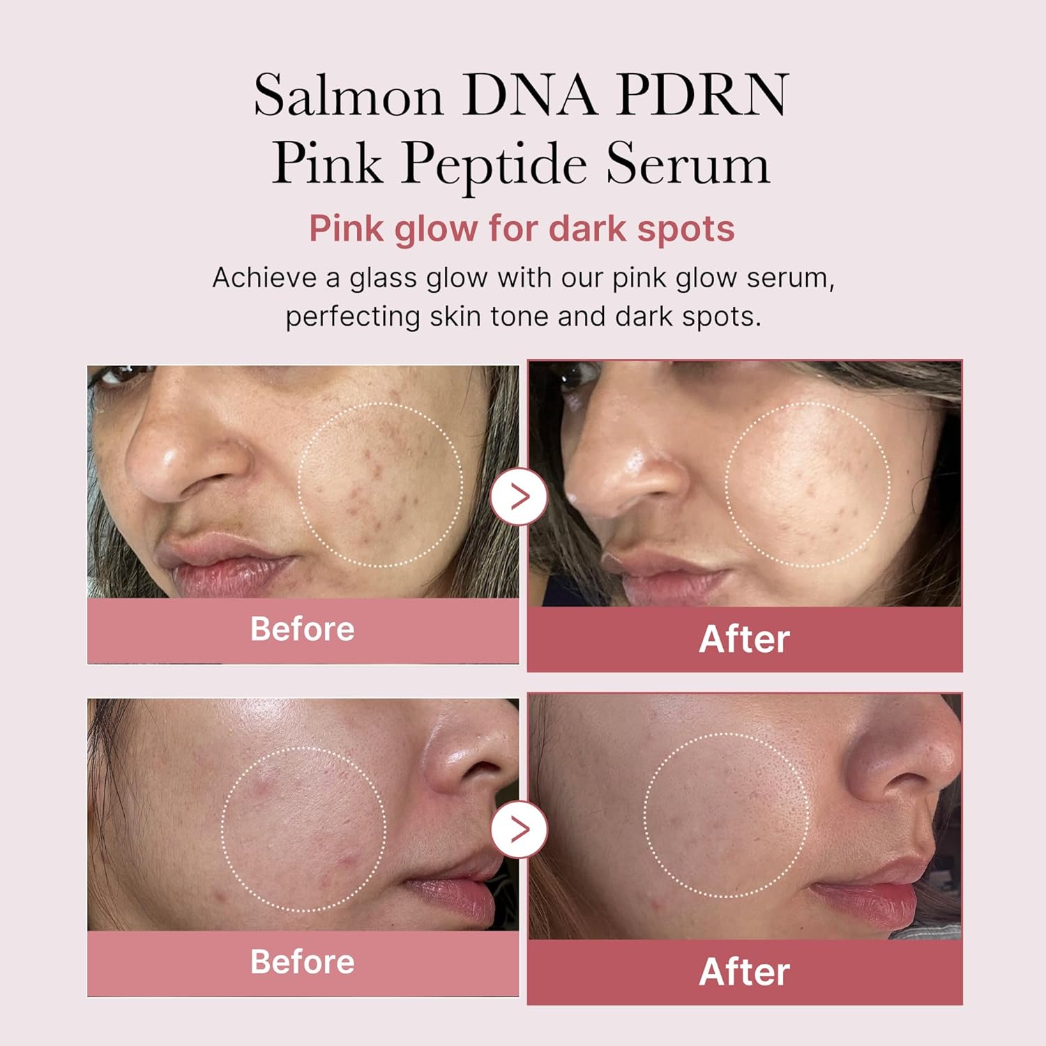 Suero Facial MEDICUBE PDRN Pink Peptide Serum 30 mL