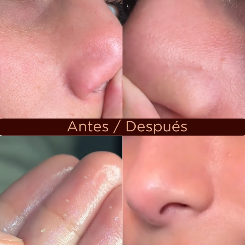 Set de Limpieza Skin1004 Madagascar Centella Double Cleansing Duo
