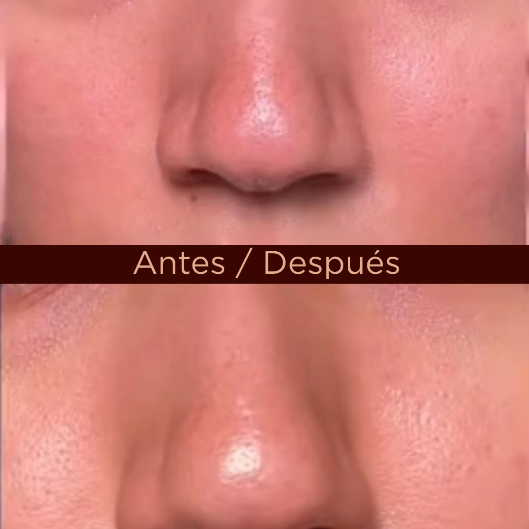 Set de Limpieza Skin1004 Madagascar Centella Double Cleansing Duo