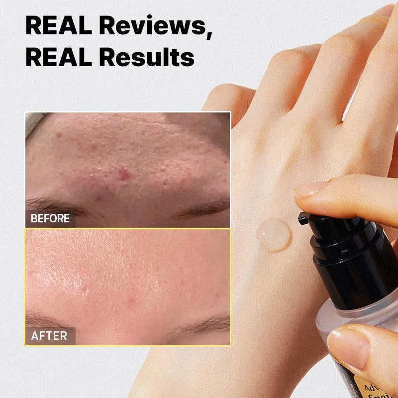 Tónico Hidratante COSRX Advanced Snail 96 Mucin Power Essence 100 mL