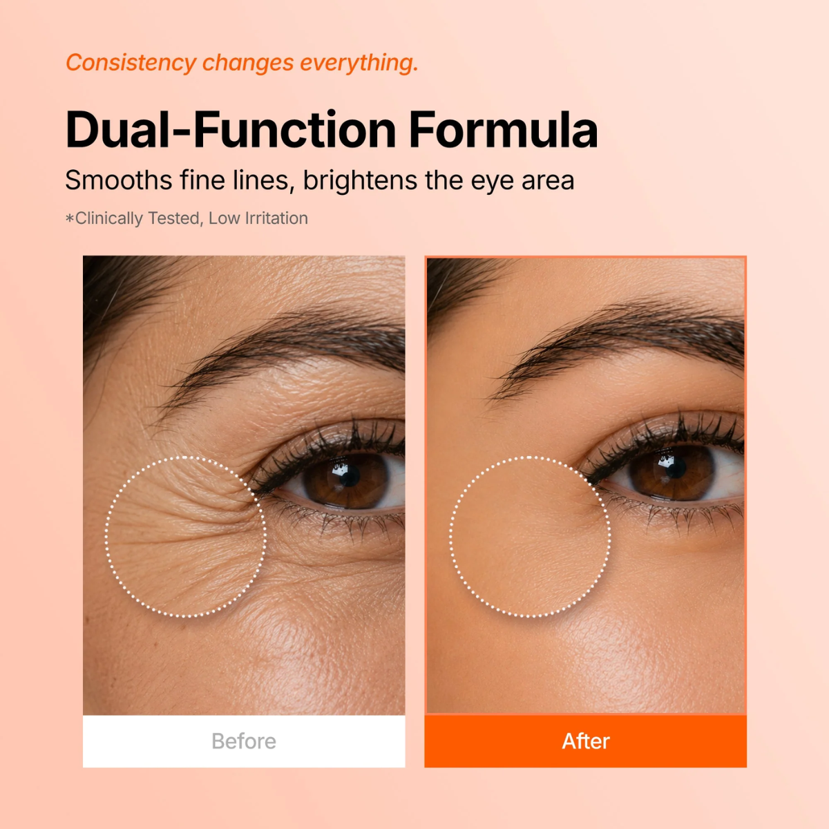 Mascarilla PDRN aplicada en el contorno de ojos