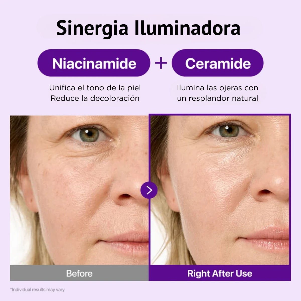 Cuidado antiedad para una mirada más lisa y luminosa