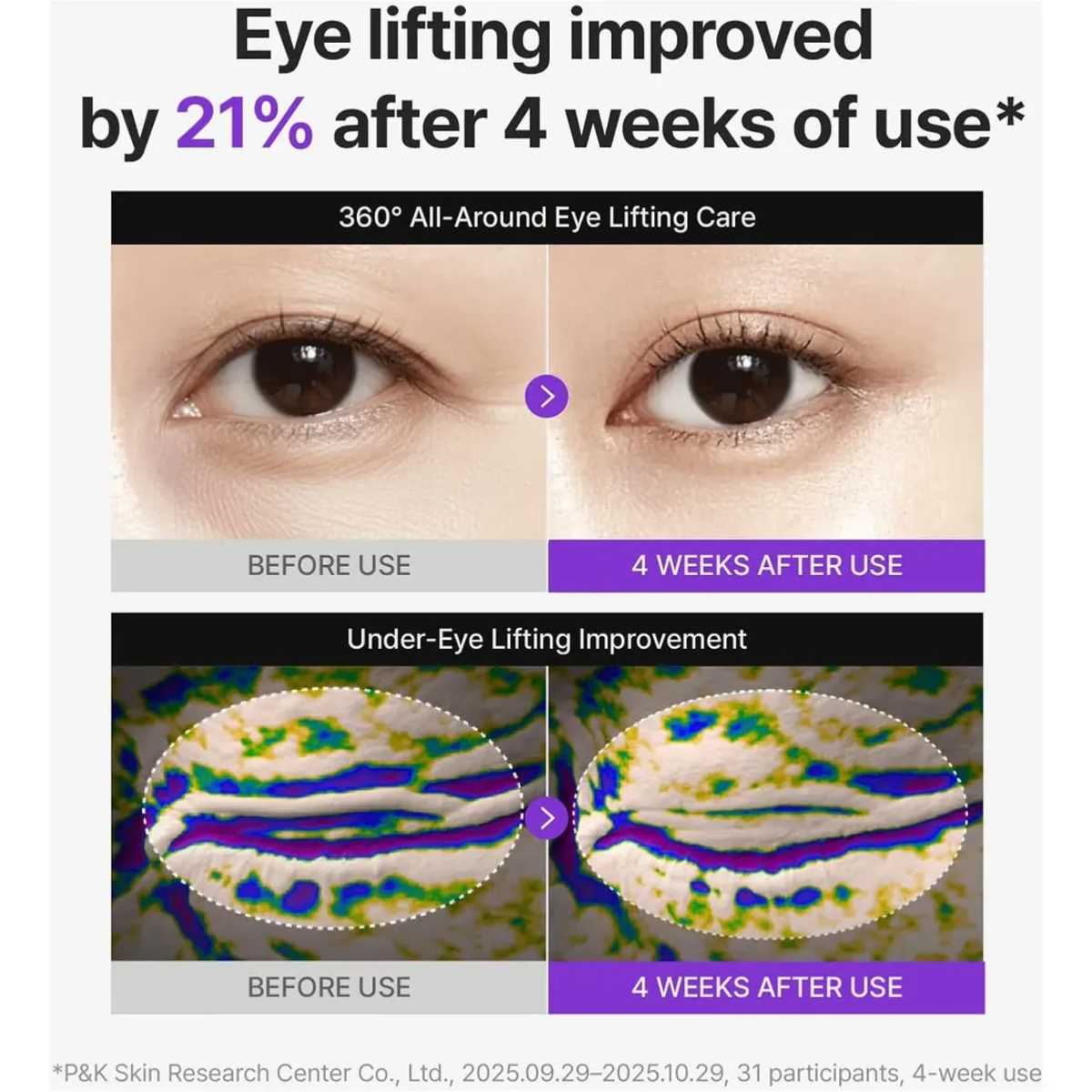 Resultados firmeza contorno ojos 4 semanas