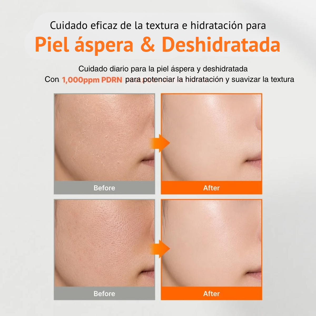 Aplicación del tónico PDRN en el rostro